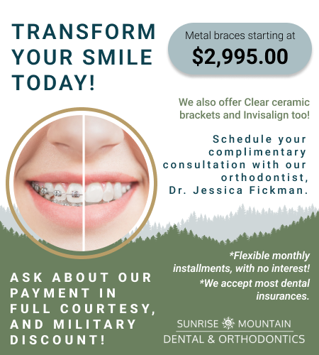 Braces Pop Up